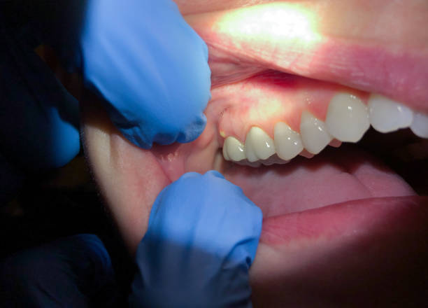Best Orthodontic Emergency Dentist in Stewart Manor, NY