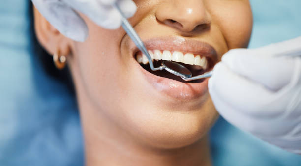Best Emergency Dentist for Knocked-Out Tooth in Stewart Manor, NY